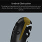 Wireless remote control electric shock male chastity cage with urethral lock and obstruction features